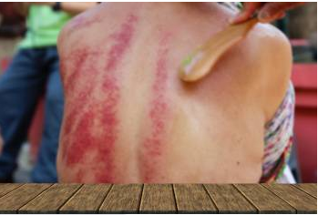 Je večji pritisk boljši v Gua Sha?