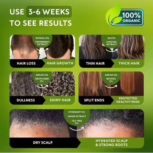 Natural Rosemary Oil Biotin Anti-Hair Loss Hair Growth Batana Oil Shampoo